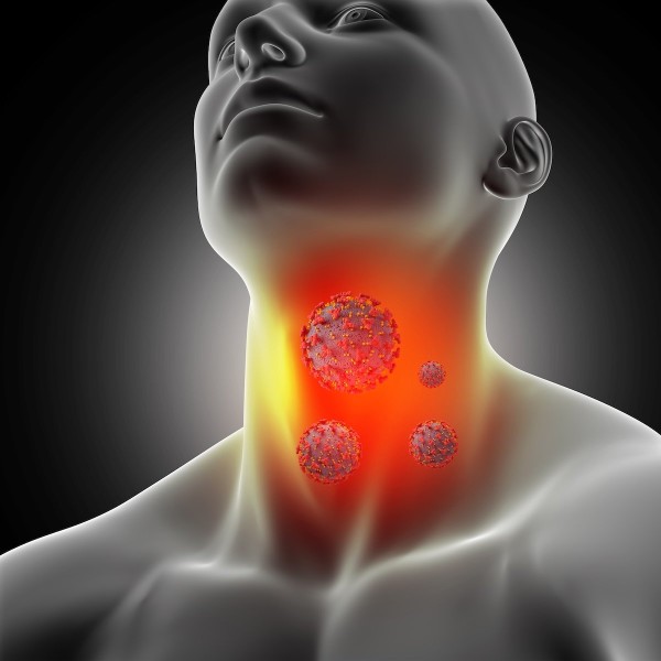 Causes & Risk Factors