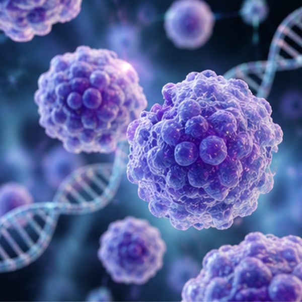 Causes and Risk Factors