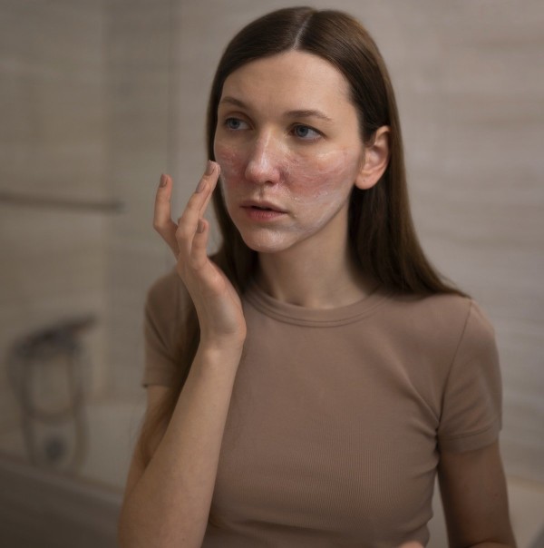 Common Skin Conditions