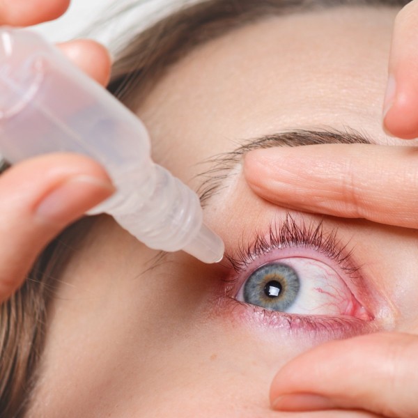 Diagnosis and Treatment