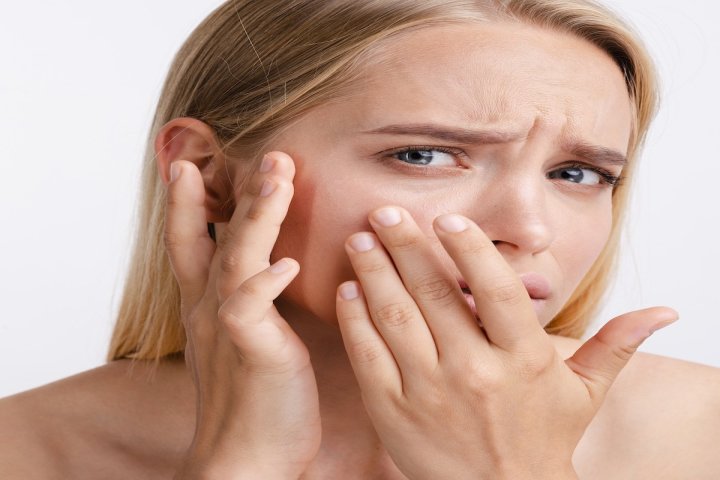Lupus category