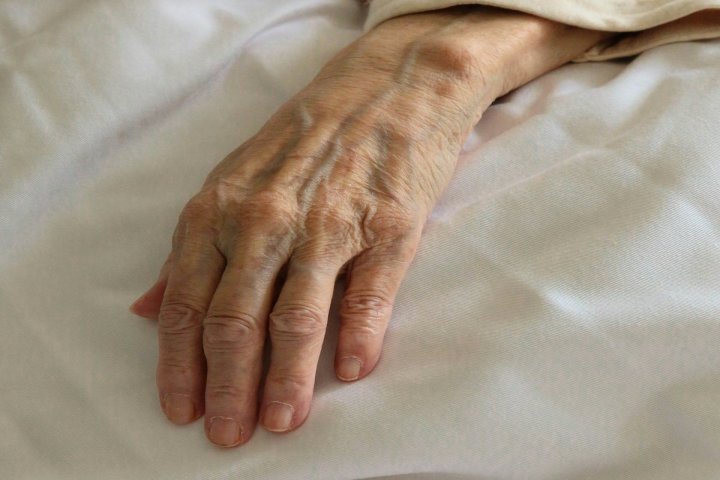 Osteoarthritis category