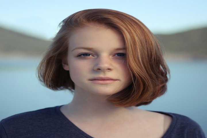 Rhinoplasty category