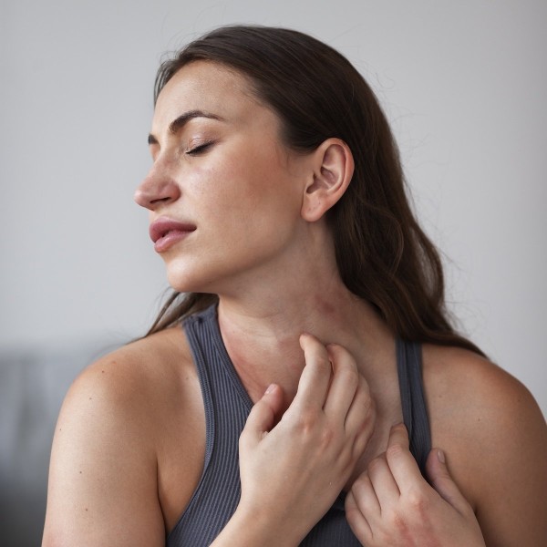 Skin Allergies and Sensitivities