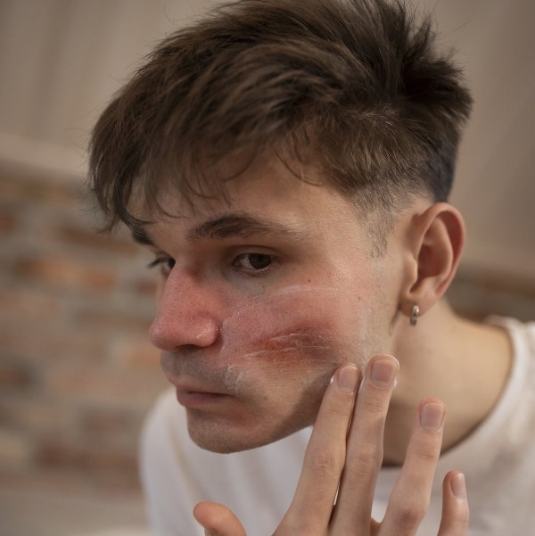 Skin Infections and Diseases