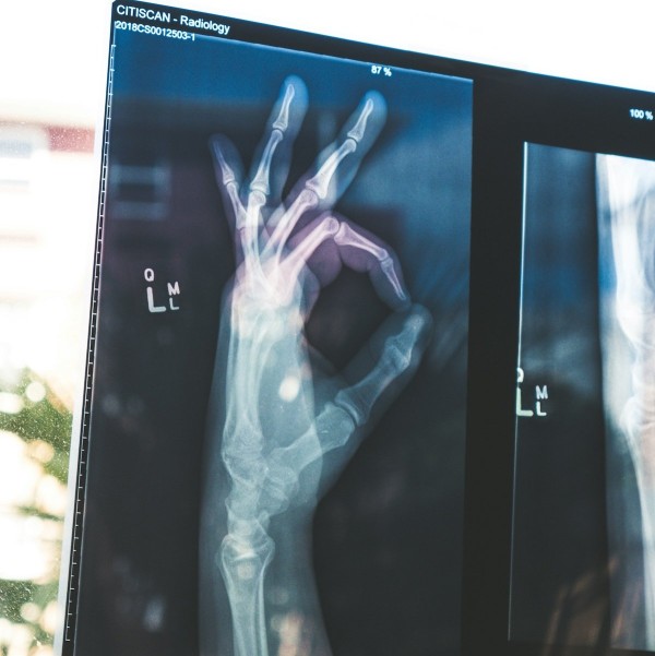 Symptoms & Diagnosis