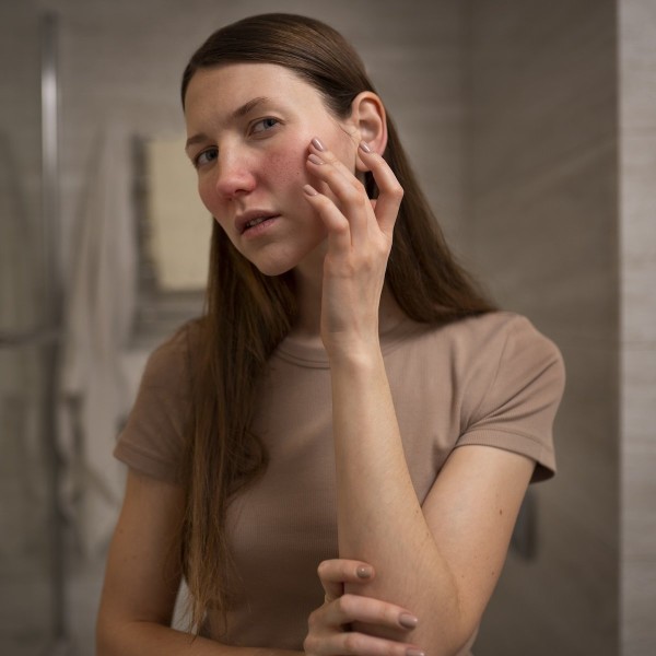 Symptoms of Food Allergies