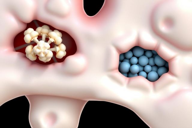 The image displays a 3D rendering of a cellular structure, likely representing a medical model or visualization. It showcases two distinct regions within the structure: one with bright blue spheres resembling beads, and another with pinkish-red oval shapes, possibly representing cells or components within the context of the image.