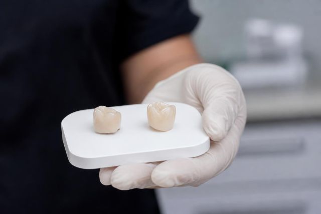 Dental clinician's gloved hand presenting two ceramic crowns on a small white dental tray, clinical setting.