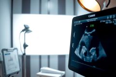 Ultrasound image of a fetus displayed on a medical monitor in a clinical setting. Black and white tones highlight the details of the scan.