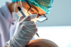 A surgeon in scrubs and mask focuses on a procedure, holding a pen. The image conveys a clinical setting with a focus on precision and detail, likely depicting medical examination or a surgical task.