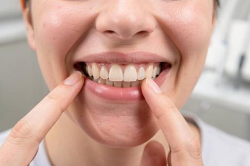 Can Root Canal-Treated Teeth Be Whitened?