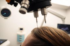 Close-up of a medical procedure, possibly injections or a hair treatment, with specialized equipment and a sterile environment. Focus on precision and healthcare technology.
