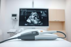 Medical ultrasound image on monitor in a clinic. Grey and white ultrasound probe rests on a white examination table. Focused on diagnostic imaging, healthcare, and medical technology. Soft, neutral colors and clinical environment.