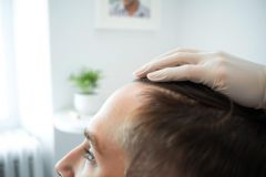 Medical examination: a doctor in gloves examines a patient's head. Healthcare setting, close-up shot, professional consultation, wellness check, dermatology.