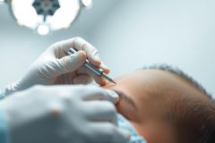 Close-up of a medical procedure, possibly an eye exam or injection, with a gloved hand holding a tool near a patient's face. Focus on precision and healthcare environment.