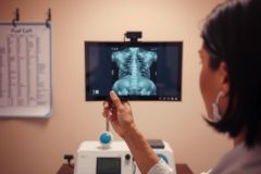 Medical professional examining an X-ray of a spine on a screen. Healthcare setting, diagnostic imaging, radiology, and medical examination visible.