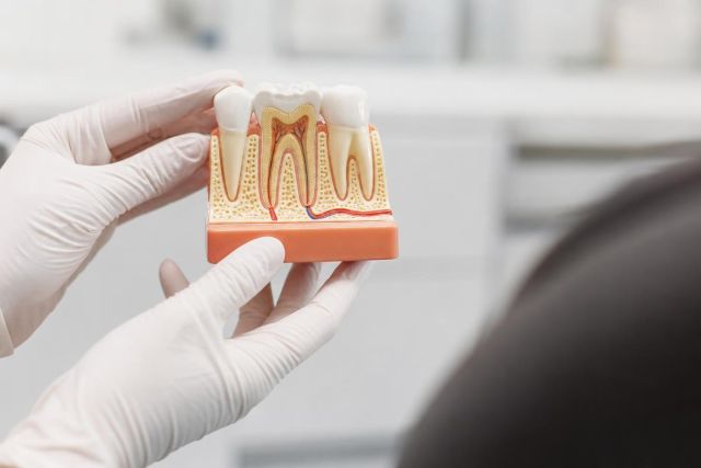 Dental professional holding tooth cross-section model in clinic, explaining wisdom tooth anatomy to patient.