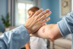 Close-up of a comforting hand placed over a child's arm with a visible bruise. Soft blue and green tones create a calming indoor setting. Focus on healing, support, and care for a minor injury. Family, child, comfort, bruise, injury.