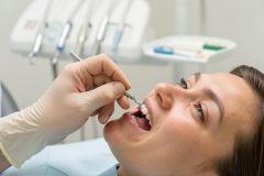 Young patient reclined in a dental chair as a gloved clinician applies restorative material to a front tooth.