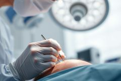 Close-up of a medical procedure. A surgeon in blue scrubs and surgical mask uses a scalpel on a patient's head, illuminated by a bright surgical lamp. The image showcases a sterile, clinical environment with a focus on precision and healthcare.