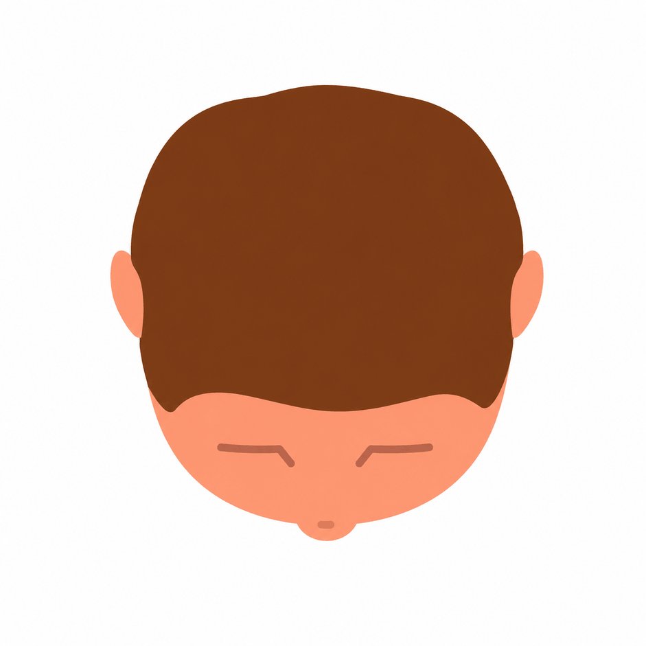 Mild thinning
